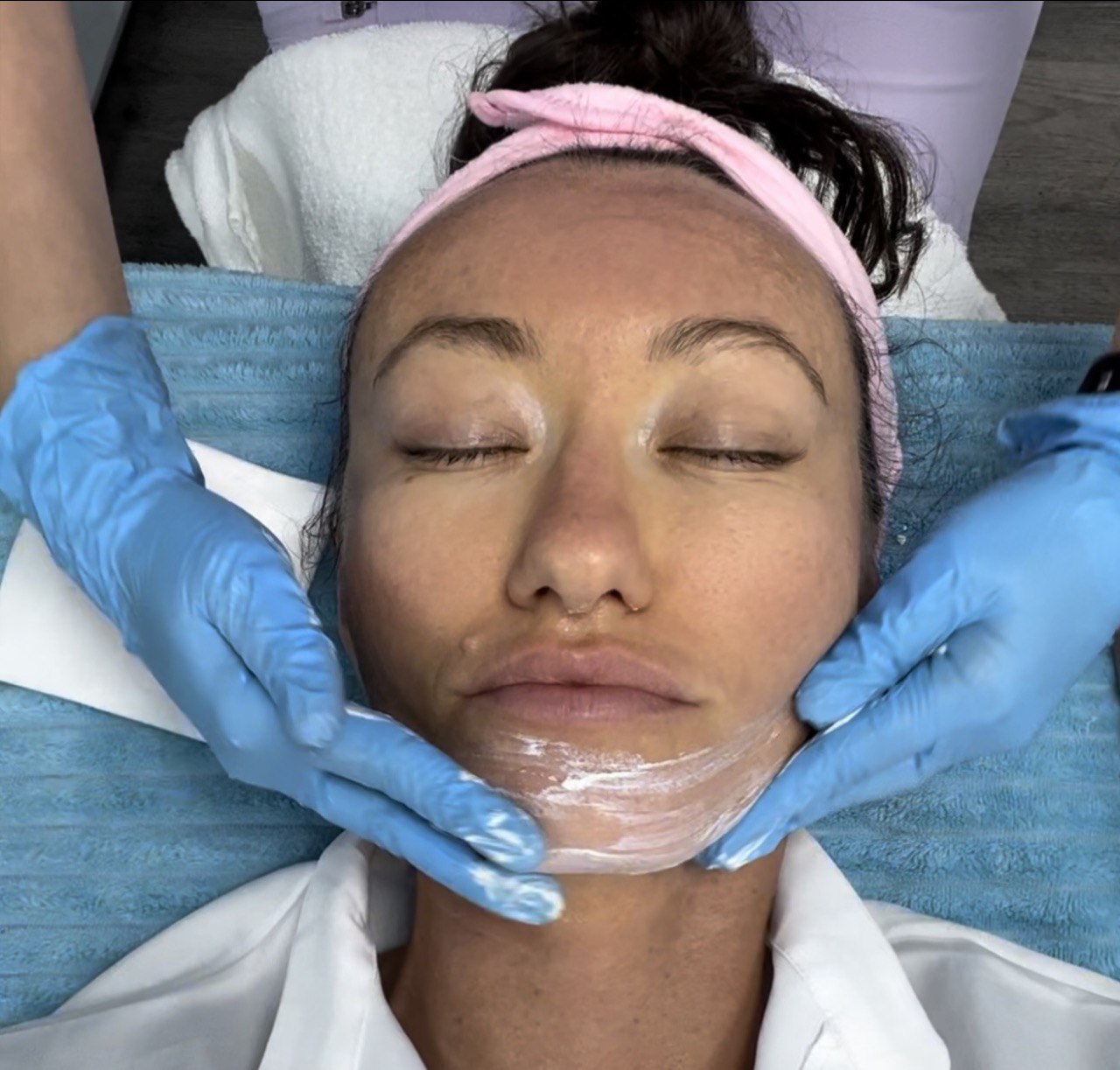 Facial Treatment